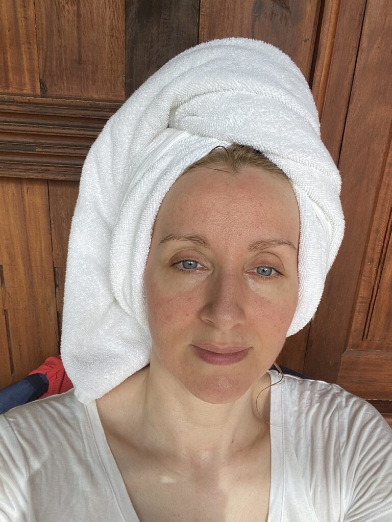 Patientin im Somatheeram Ayurveda Resort in Indien